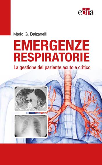Emergenze respiratorie. La gestione del paziente acuto e critico - Mario Giosuè Balzanelli - Libro Edra 2022 | libraccio.click