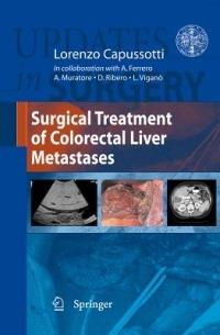Surgical treatment of colorectal liver metastases - Alessandro Ferrero, Andrea Muratore, Dario Ribero - Libro Springer Verlag 2010 | libraccio.click