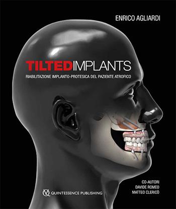 Tilted implants. Riabilitazione implanto-protesica del paziente atrofico - Enrico Agliardi, Davide Romeo, Matteo Clericò - Libro Quintessenza 2018 | libraccio.click